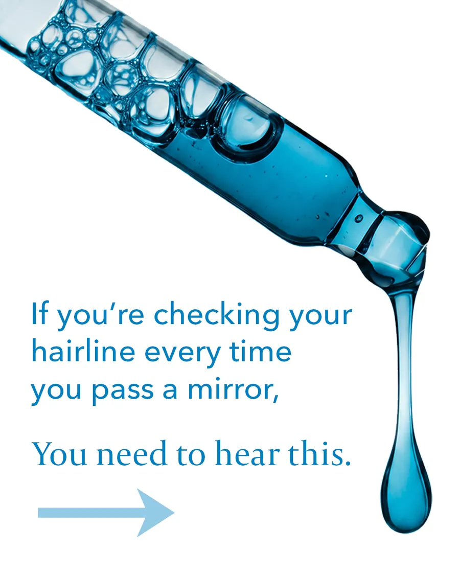 Carousel: If you're checking your hairline